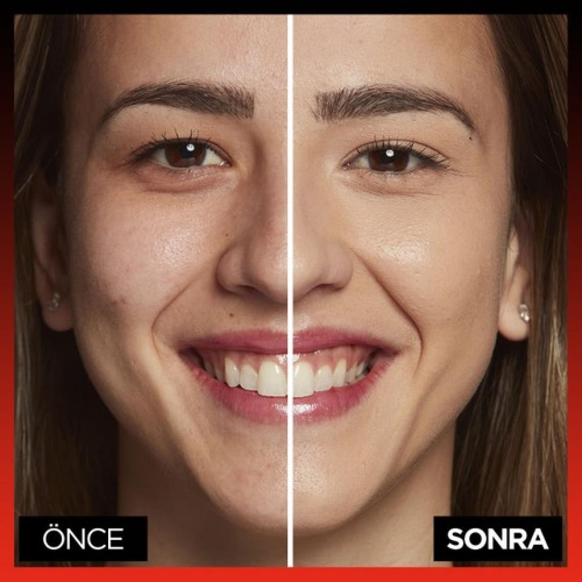 Loreal Paris Infaillible More Than Concealer 330 Pecan Tüm Yüze Uygulanabilir Kapatıcı