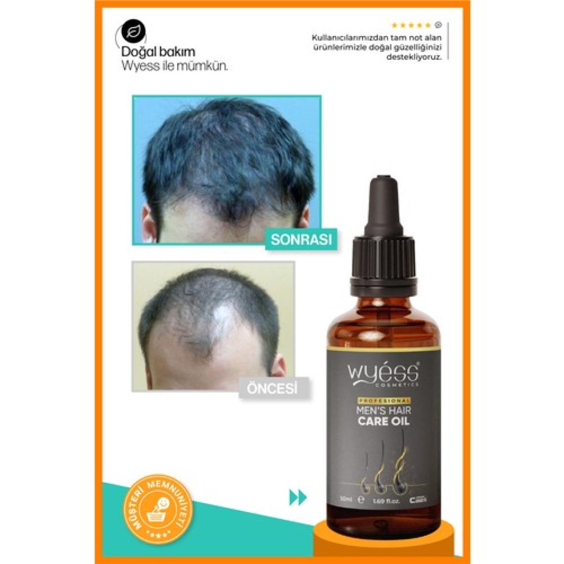 Wyess Erkek Saç Bakım Yağı - Saç Çıkarıcı & Besleyici Etki, E & A Vitaminli 50 ml