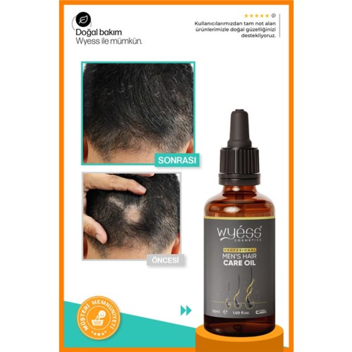 Wyess Erkek Saç Bakım Yağı - Saç Çıkarıcı & Besleyici Etki, E & A Vitaminli 50 ml