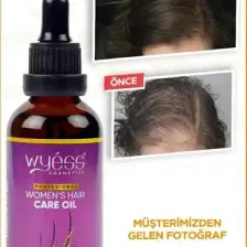 Wyess Kadınlara Özel Saç Bakım Yağı Yeni Saç Teli Çıkaran Kenevir Yağı 50 ml