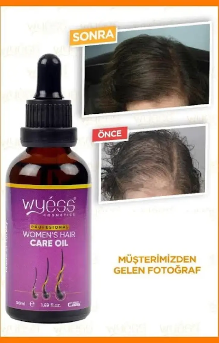 Wyess Kadınlara Özel Saç Bakım Yağı Yeni Saç Teli Çıkaran Kenevir Yağı 50 ml