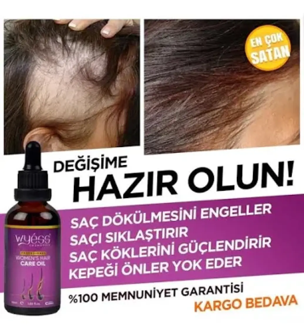 Wyess Kadınlara Özel Saç Bakım Yağı Yeni Saç Teli Çıkaran Kenevir Yağı 50 ml