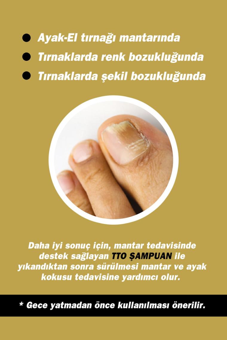 Gold Naıl Tırnak Solüsyonu 15 ml Tırnak Mantarı Ve Renk Bozukluğu(ÇAY AĞACI YAĞI / TEA TREE OIL)