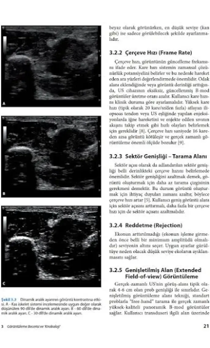 Fiziksel Tıp ve Rehabilitasyonda Kas Iskelet Sistemi Ultrasonografisi