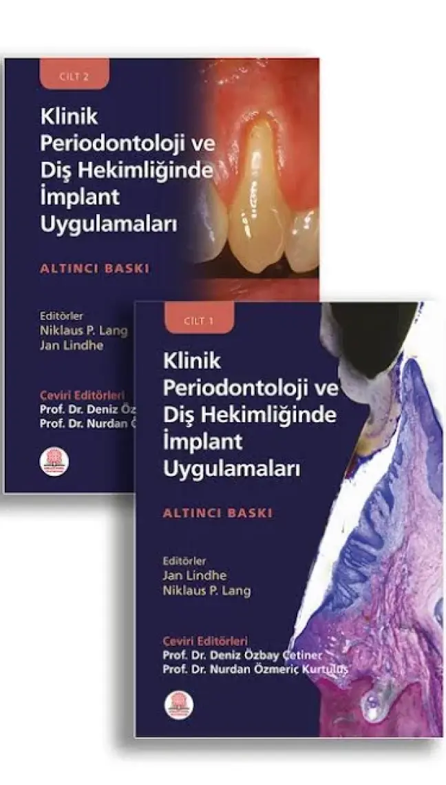 Klinik Periodontoloji ve Diş Hekimliğinde Implant Uygulamaları Cilt 1 - 2