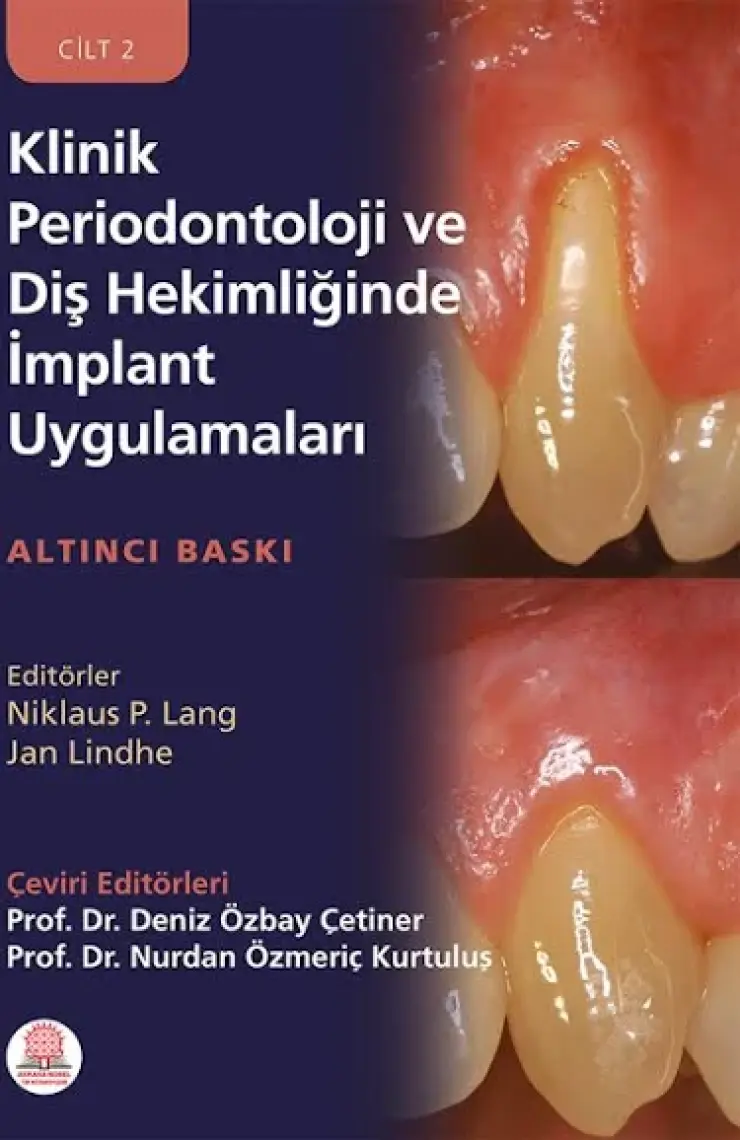 Klinik Periodontoloji ve Diş Hekimliğinde Implant Uygulamaları Cilt 1 - 2