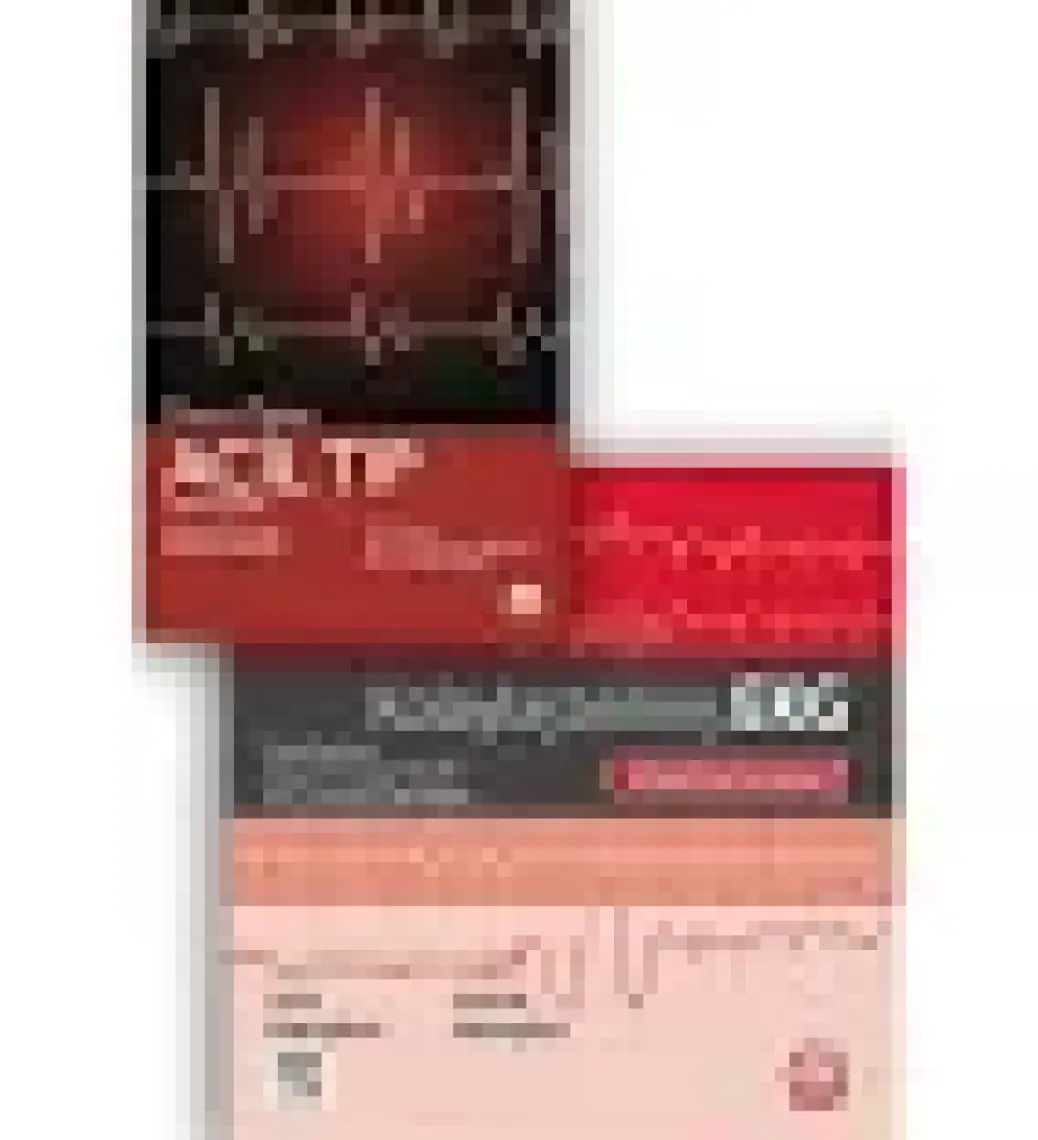 Kolaylaştırılmış Ekg - Kıvanç Yalın - Barış Ikitimur