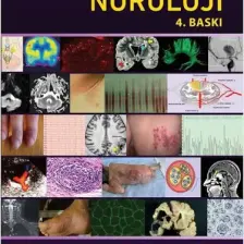 Nöroloji (4. Baskı) - A. Emre Öge (Ciltli)