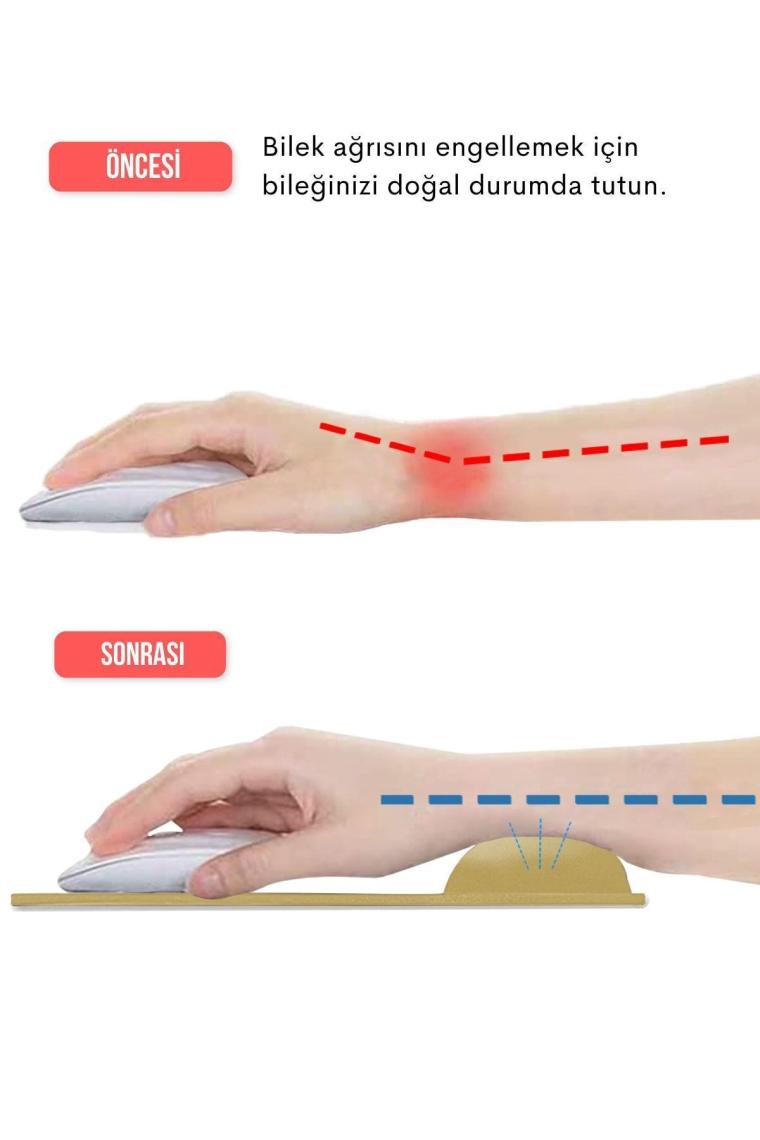 Deer Siyah Bilek Destekli Mouse Pad,ergonomik Kaymaz Taban,oyun ve Ofis Için Fare Altlığı,suya Dayanıklı (Turuncu)