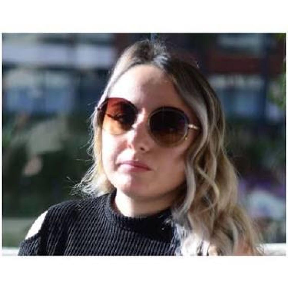 Osse OS 2556 02 Güneş Bayan GÖZLÜĞÜ