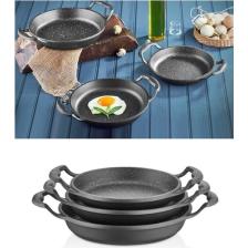 Elit Mutfak Gri Granit Kaplama Alüminyum Döküm Sahan Set 3'lü(18-20-22 Cm)