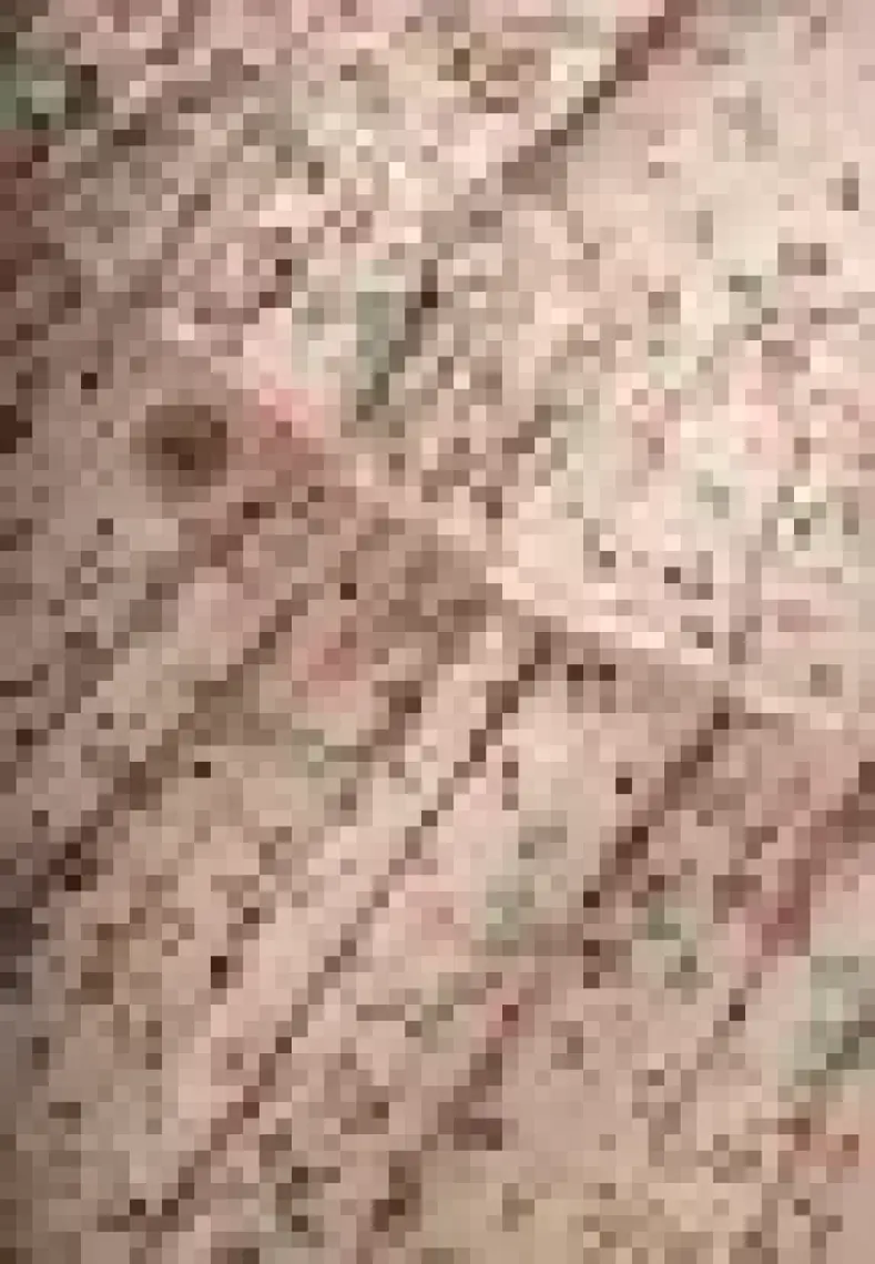 Çıtır Desen Müslin Elbise 0-8 Yaş Pudra Pembe