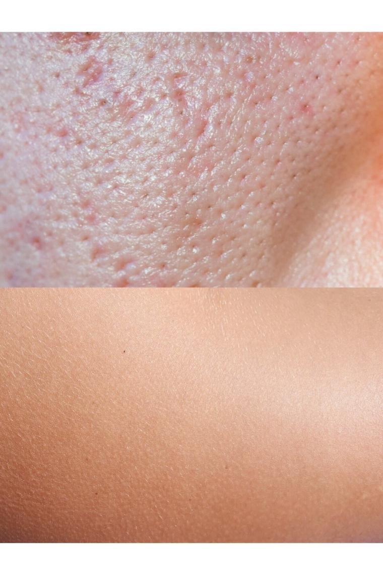 Gözenek Sıkılaştırıcı Arındırıcı Ve Kararma Karşıtı Tonik - Purifying And Exfoliating Tonic 200ml