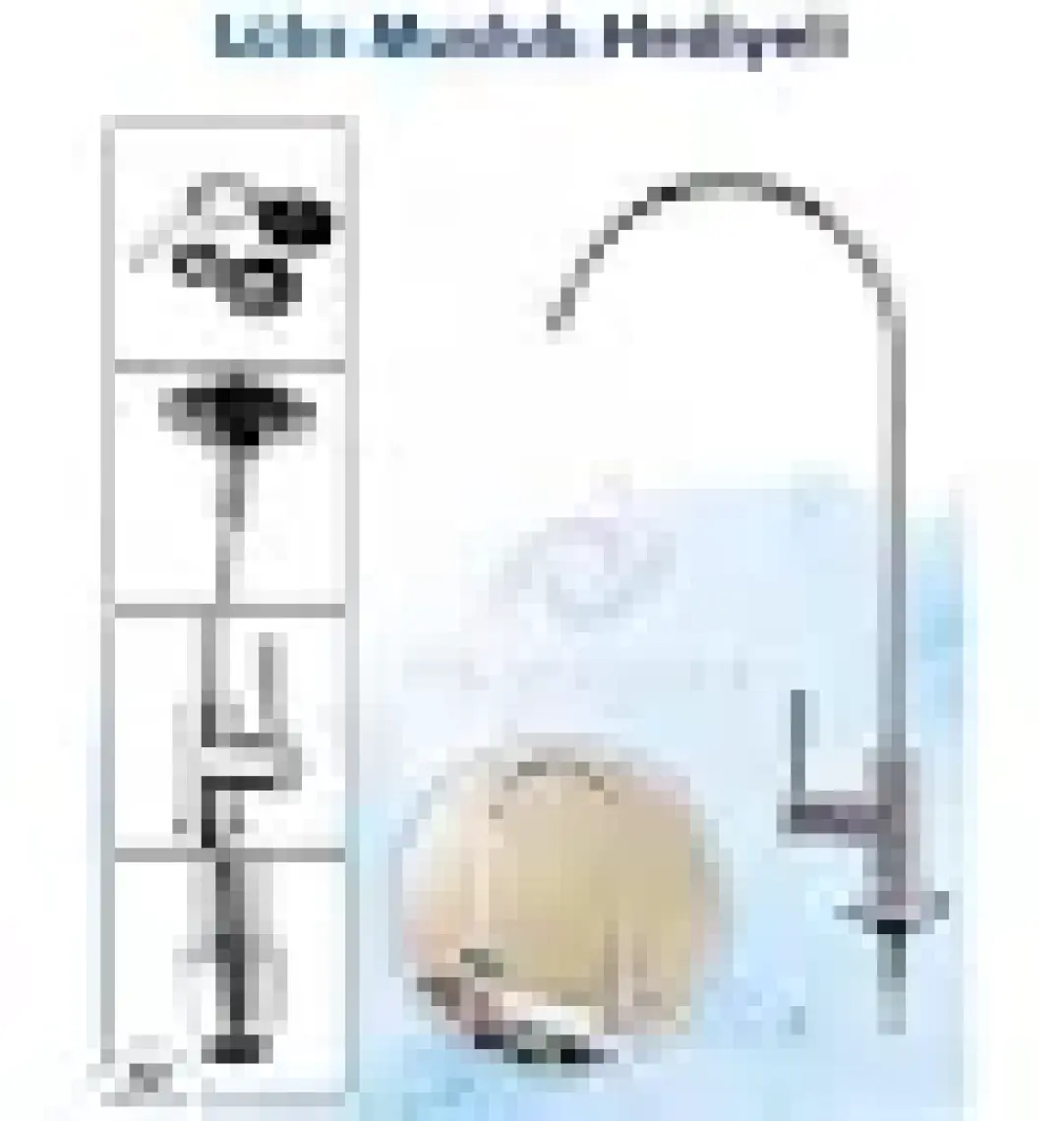Piksel Aqua 5 Aşamalı Açık Kasa Su Arıtma Cihazı