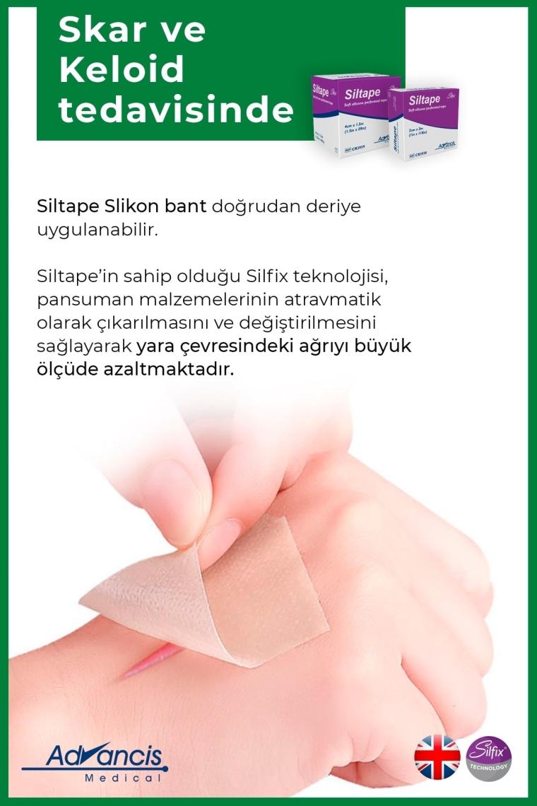 Siltape Soft Silikon Bant Yara Izi - Dikiş Izi - Sezaryen - Yanık - Estetik 2cm X 3mt