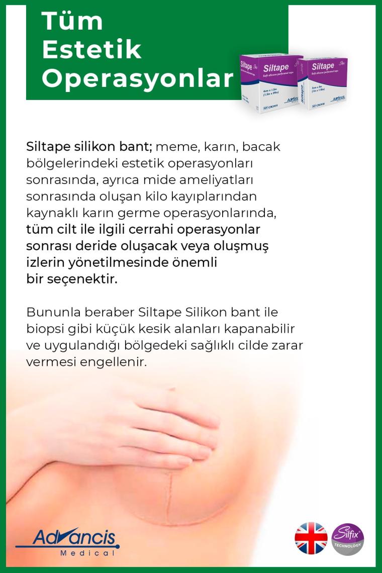 Siltape Soft Silikon Bant Yara Izi - Dikiş Izi - Sezaryen - Yanık - Estetik 2cm X 3mt