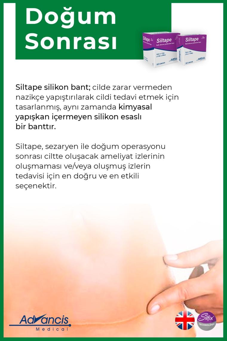 Siltape Soft Silikon Bant Yara Izi - Dikiş Izi - Sezaryen - Yanık - Estetik 2cm X 3mt