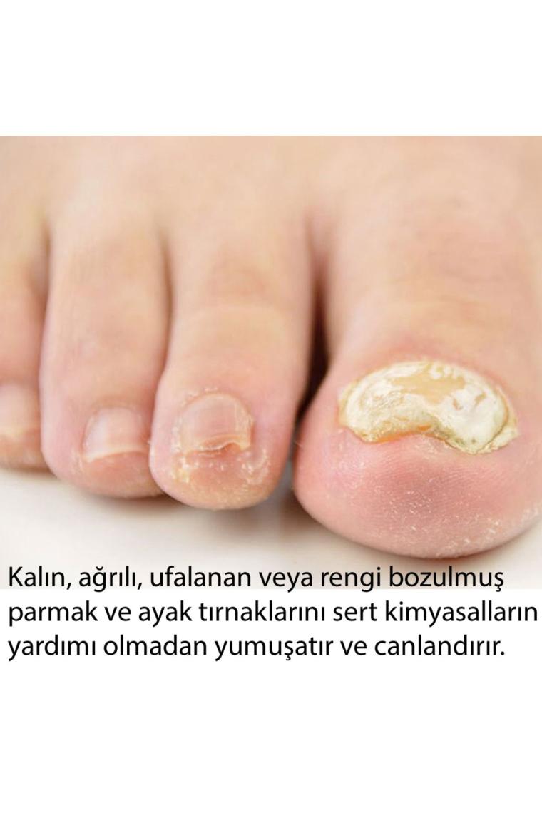 Dr. Nails Tırnak Bakım Yağı
