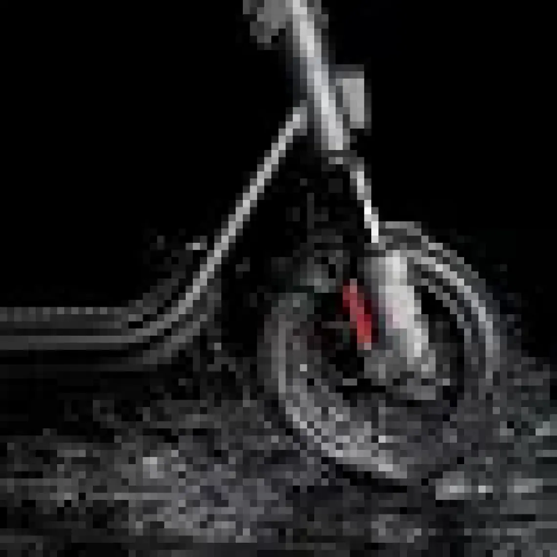 Segway Ninebot F2 II (2025)  Elektrikli Scooter