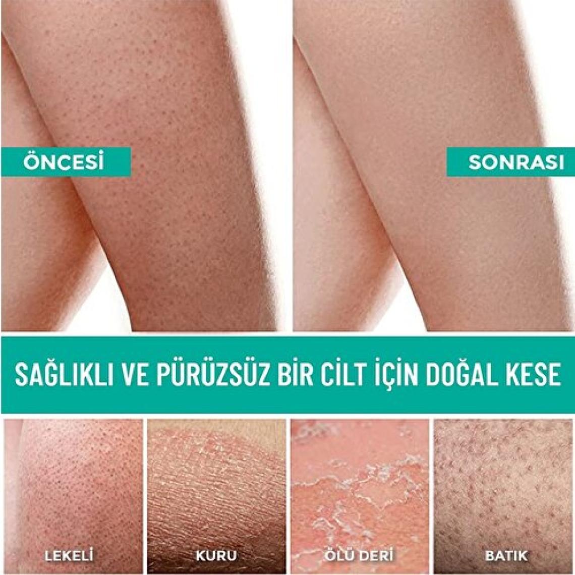 Dermapeel Pink Touch Banyo Kesesi