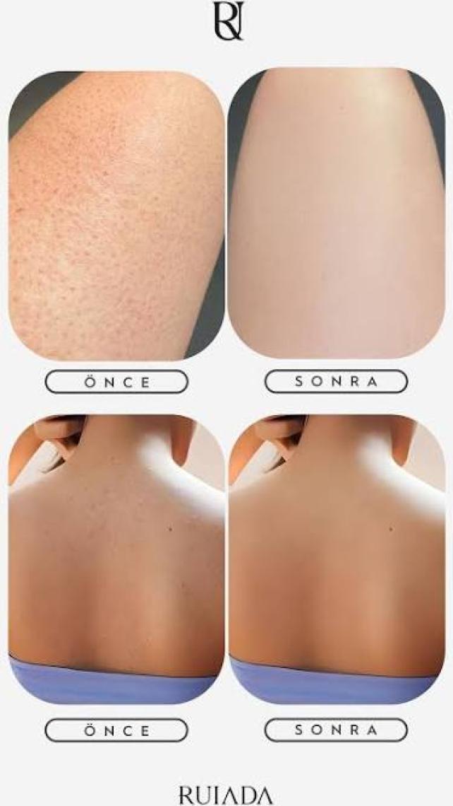 Ruiada +80 Factor Ekru Banyo Duş Kesesi Peeling Eldiveni %100 Floş İpek Premium Kadın Ve Erkekler İçin