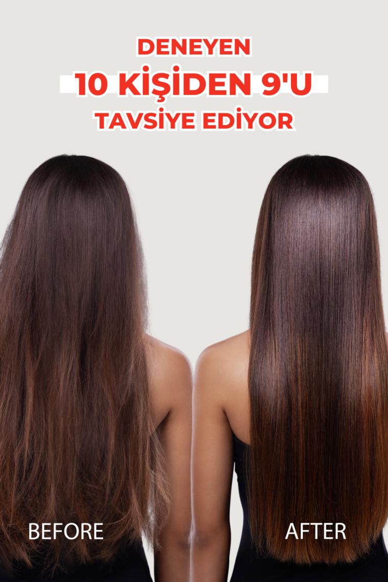 Zigavus Forte Ultra Clinical Kuru Saçlar için Şampuan 300 ml - 3 Al 2 Öde