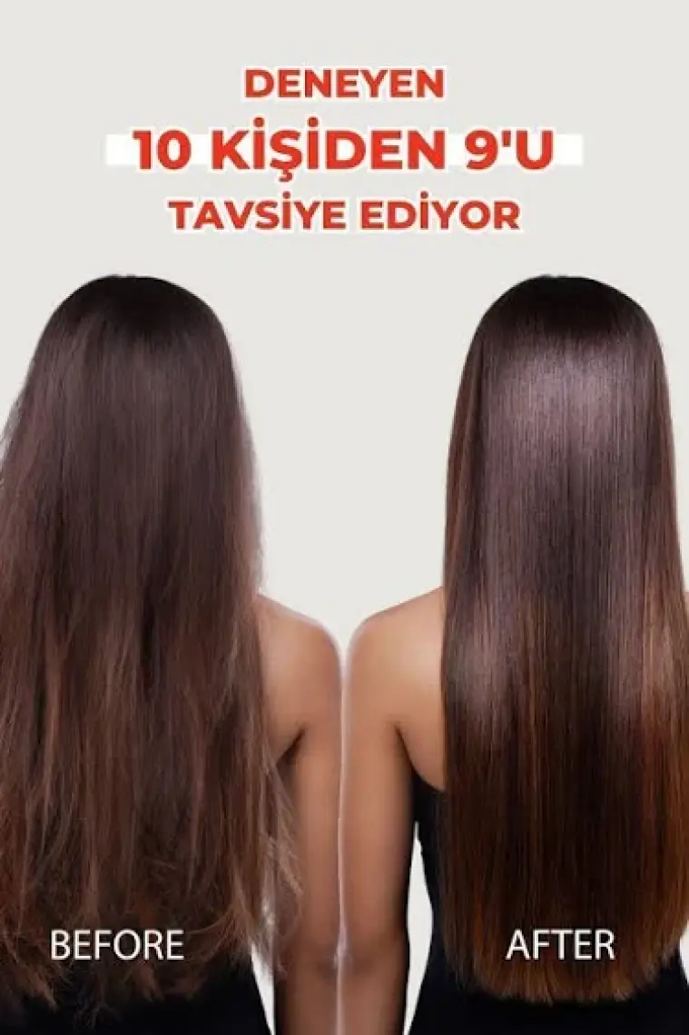 Zigavus Uzamayan ve Kırılan Saçlar için Nar Ekstraklı Şampuan 450ml