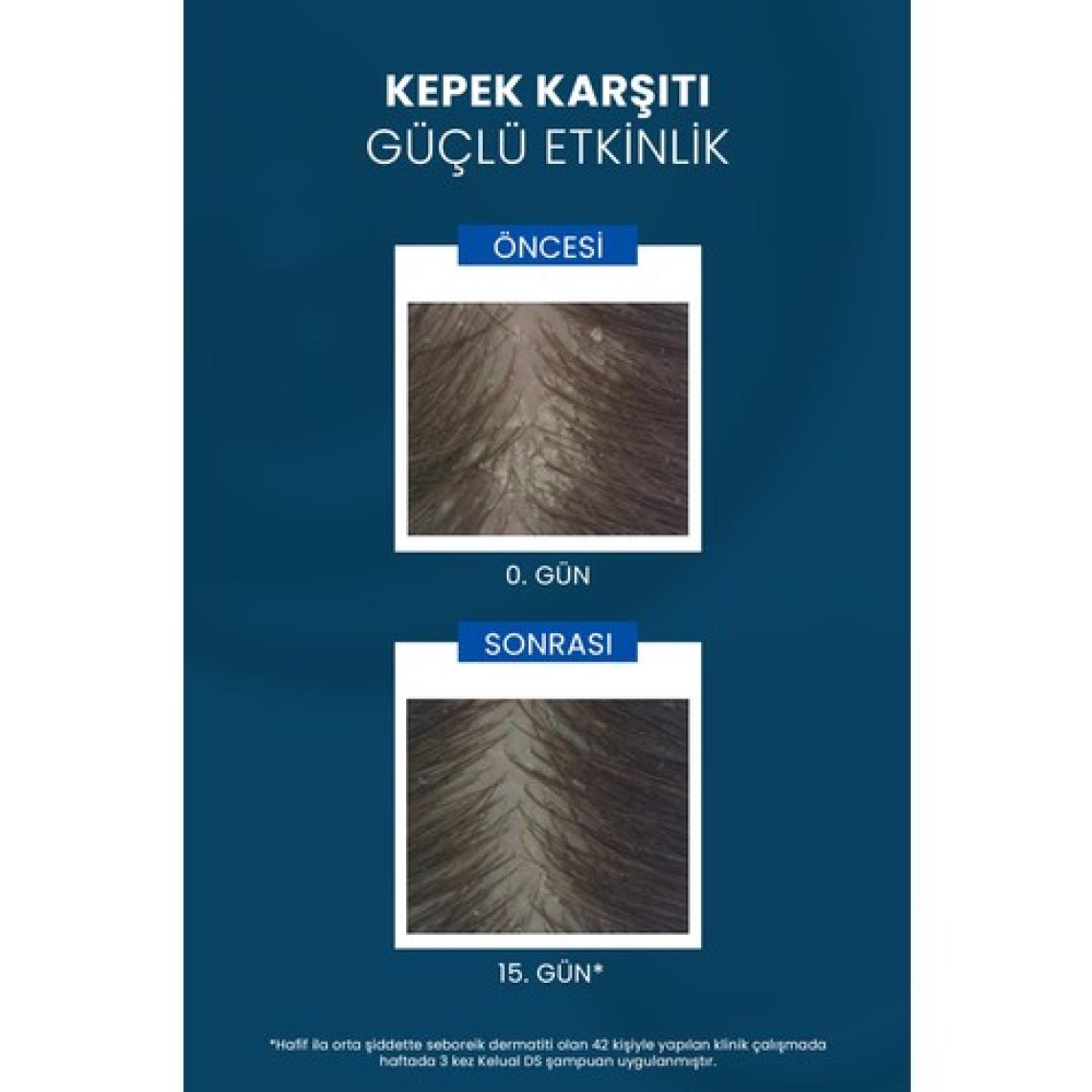 Ducray Kelual DS Yoğun Kepek Önleyici Şampuan - Boyalı Saçlar için Dermatolojik Bakım, 100 ml