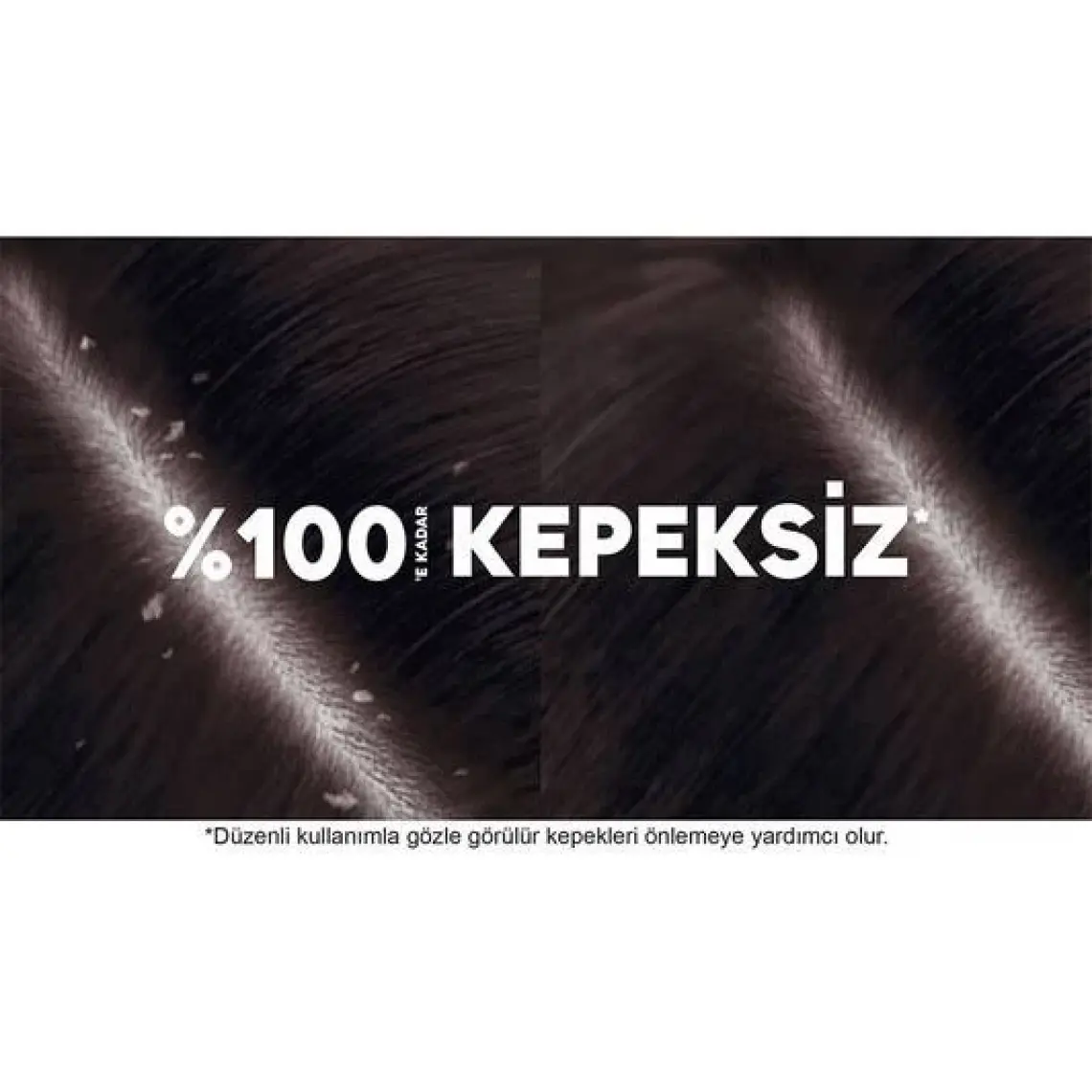 Head & Shoulders Mentol Ferahlığı 2si1 Arada Kepeğe Karşı Etkili Şampuan 330ML