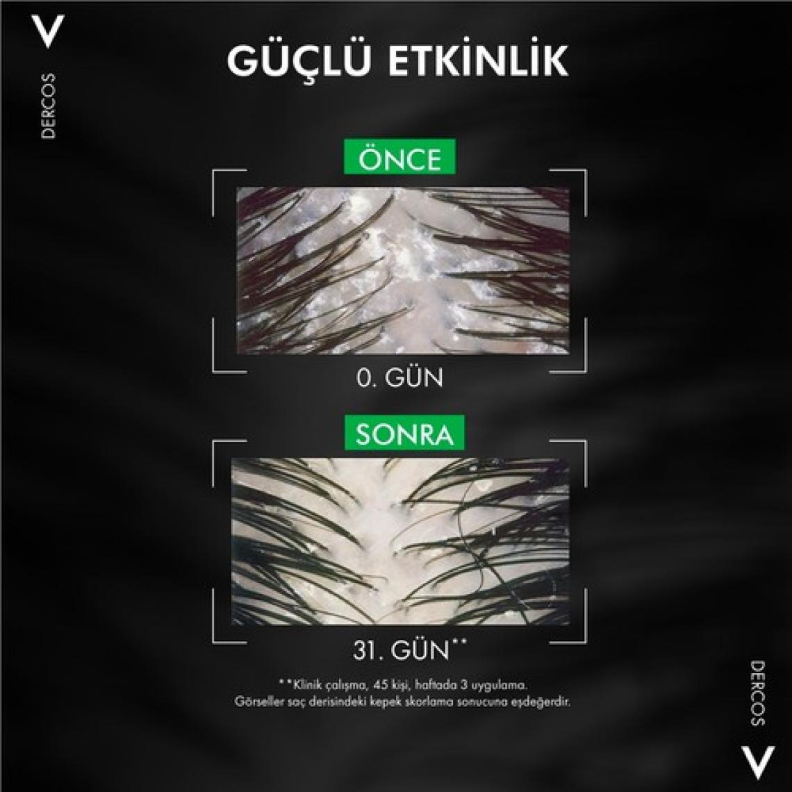 Vichy Dercos Anti-Dandruff Kuru Saçlar için Kepeğe Karşı Şampuan 500 ml