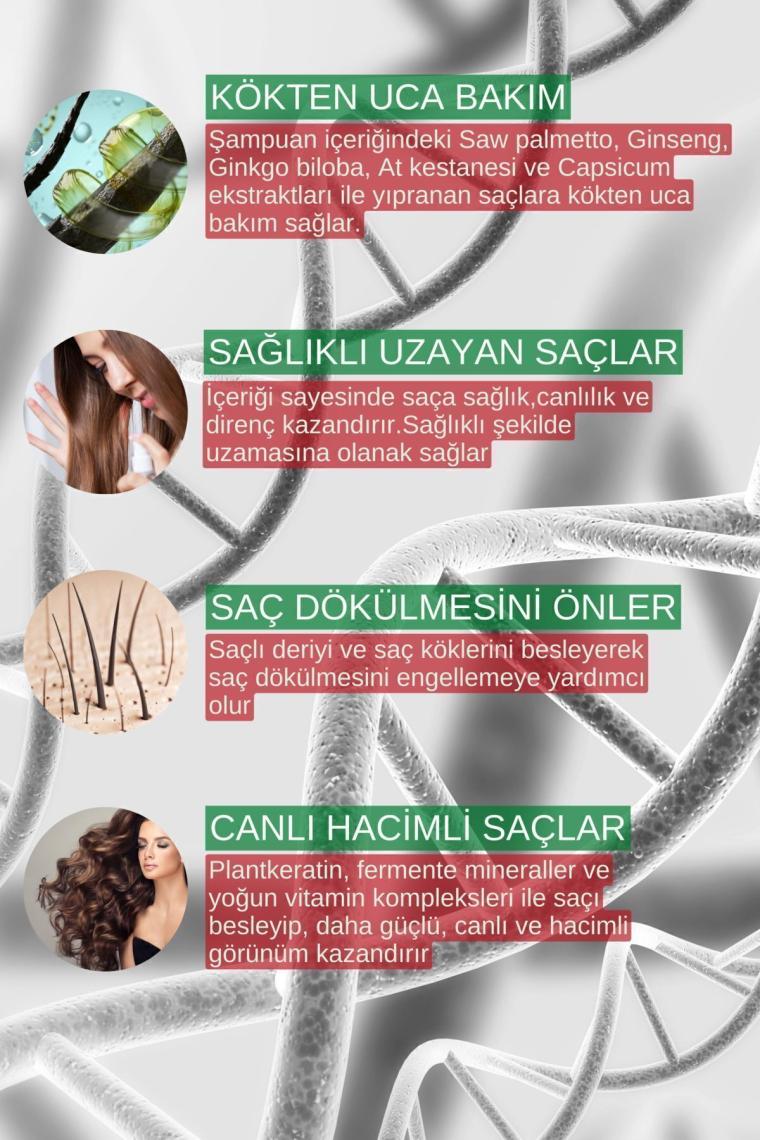 Zigavus Forte Ultra Clinical Kuru Saçlar için Şampuan 300 ml - 3 Al 2 Öde
