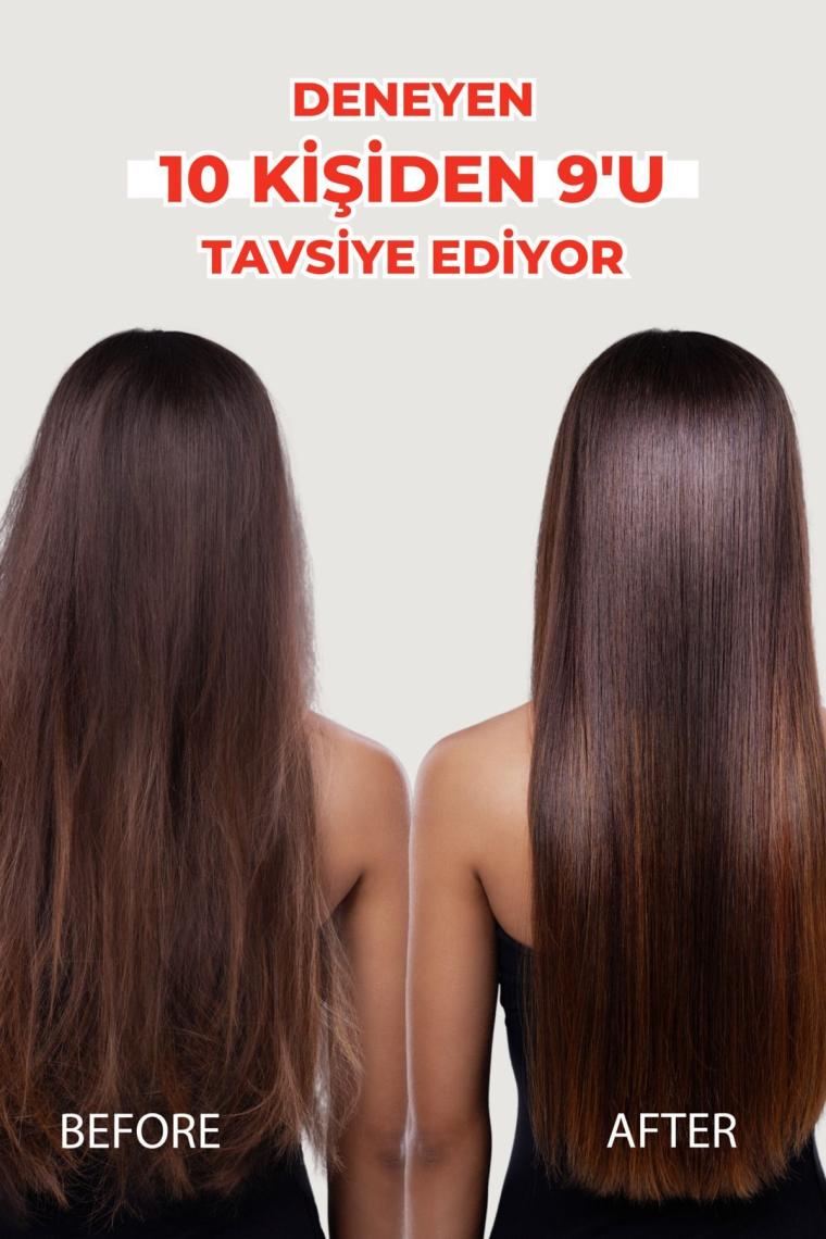 Zigavus Forte Ultra Clinical Kuru Saçlar için Şampuan 300 ml - 3 Al 2 Öde