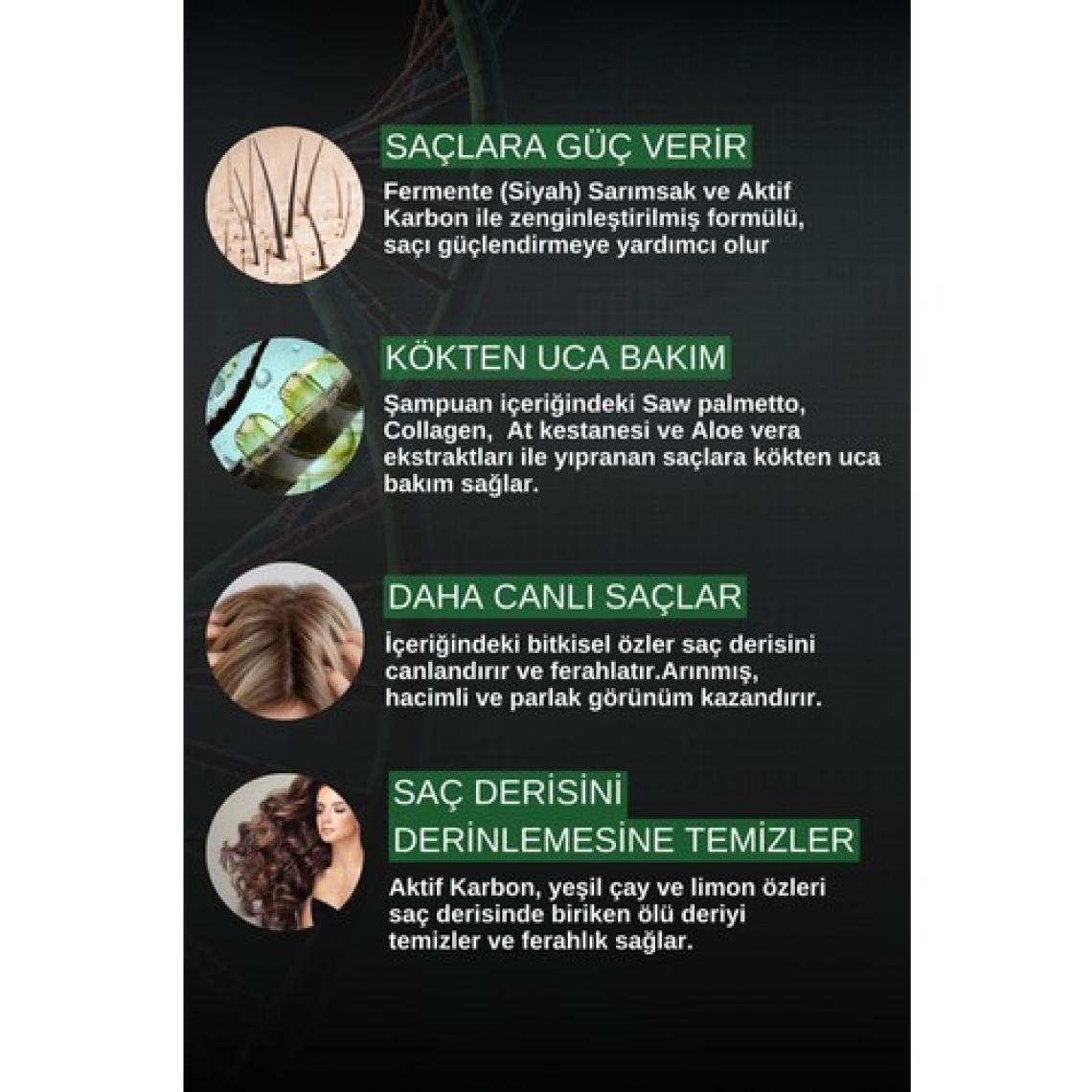 Zigavus Black Siyah Sarımsaklı Dökülme Karşıtı Şampuan - Tüm Saç Tipleri İçin Bitkisel Özler ile 300 ml