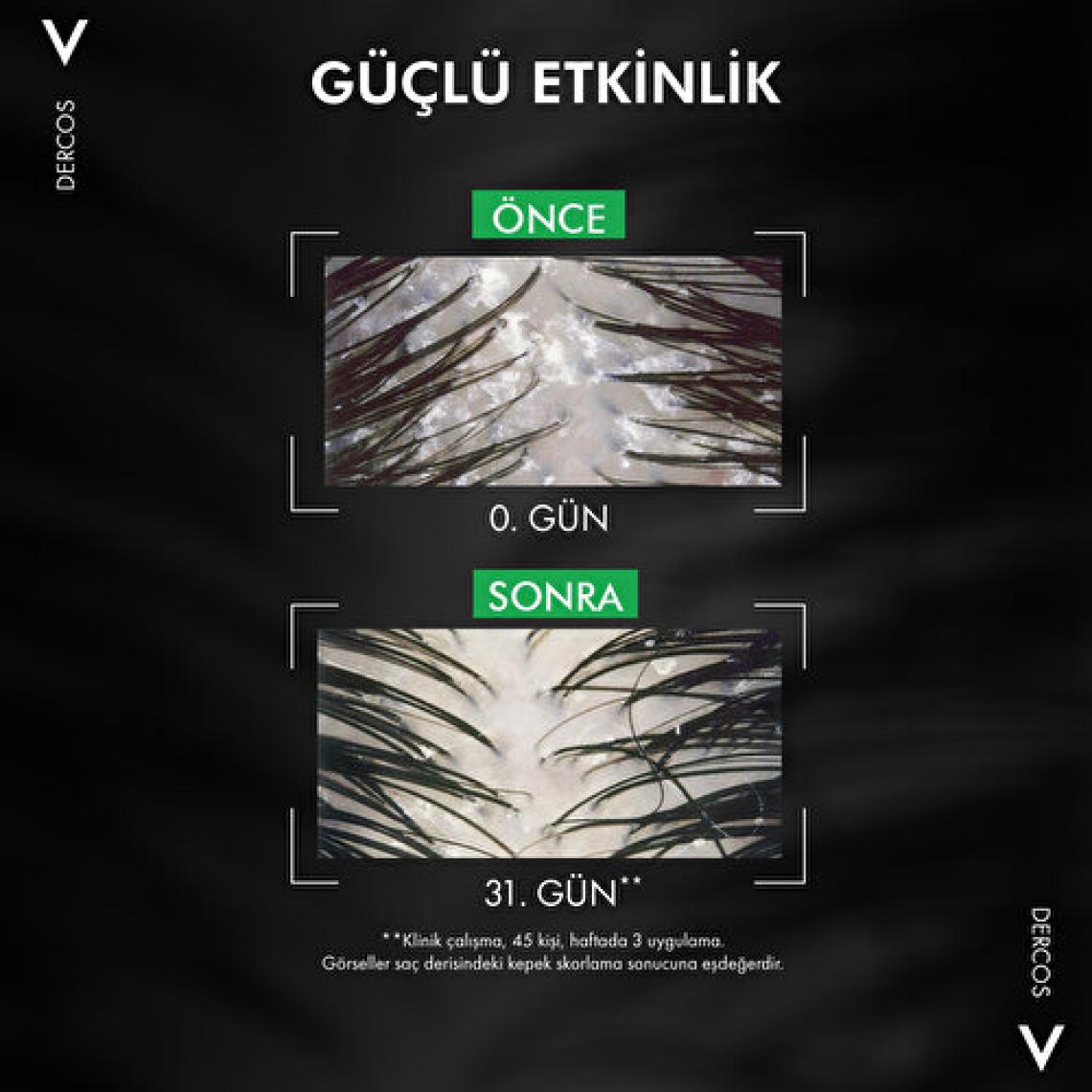Dercos Anti-Dandruff Normal ve Yağlı Saçlar Için Kepeğe Karşı Etkili Bakım Şampuanı 390 ml X2