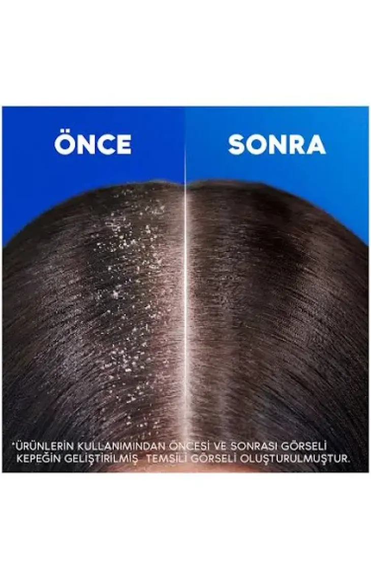 Head&Shoulders Klasik Bakım 2'si 1 Arada Şampuan 300 ml