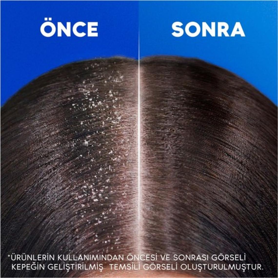 Head & Shoulders Limon Ferahlığı Kepek Karşıtı yağlı saçlar için Günlük Kullanım 330ML Şampuan