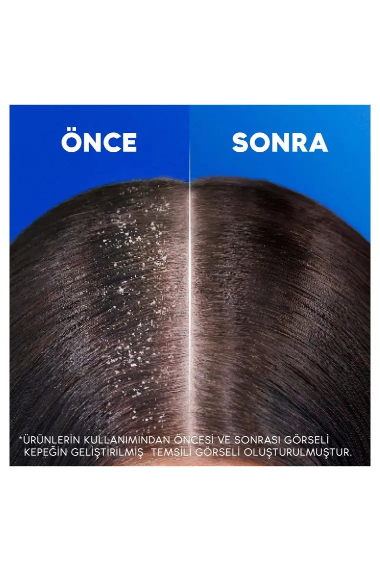 Head & Shoulders 2'si 1 Arada Kepek  Şampuan Klasik Bakım 625 ml