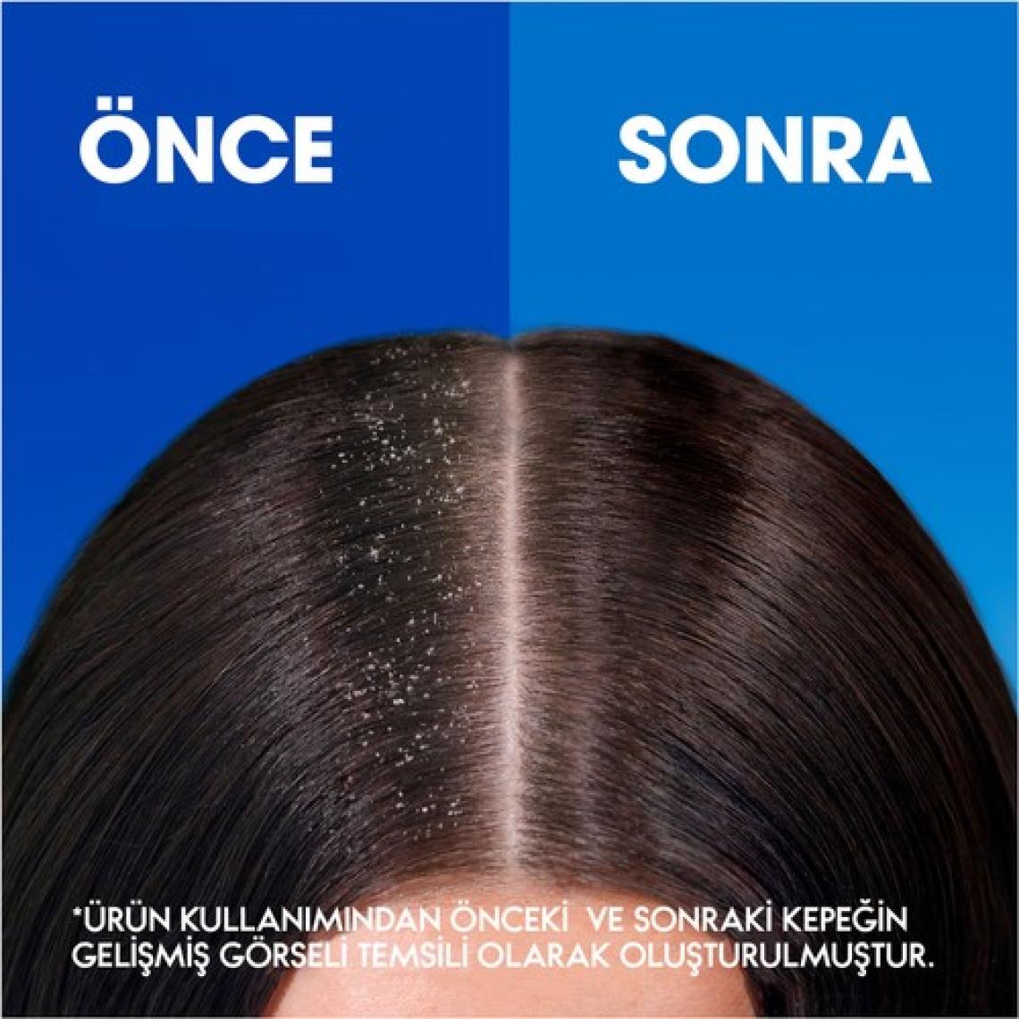 Head & Shoulders Klasik Bakım Kepek Karşıtı 750ML Günlük Kullanım Şampuan