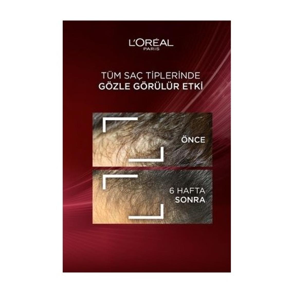 L'Oréal Paris Elseve Komple Direnç Şampuan 300 ml