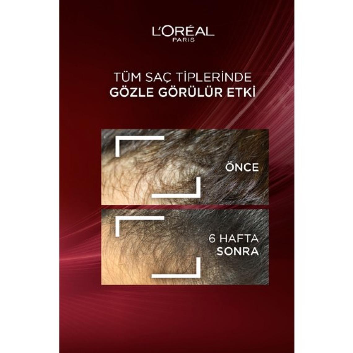 L'Oréal Paris Elseve Güçlendirici Şampuan - Koparak Dökülmeye Karşı Aminexil ve Biotin İçerir, 300 ml, Bitkisel Formül, Paraben İçermez