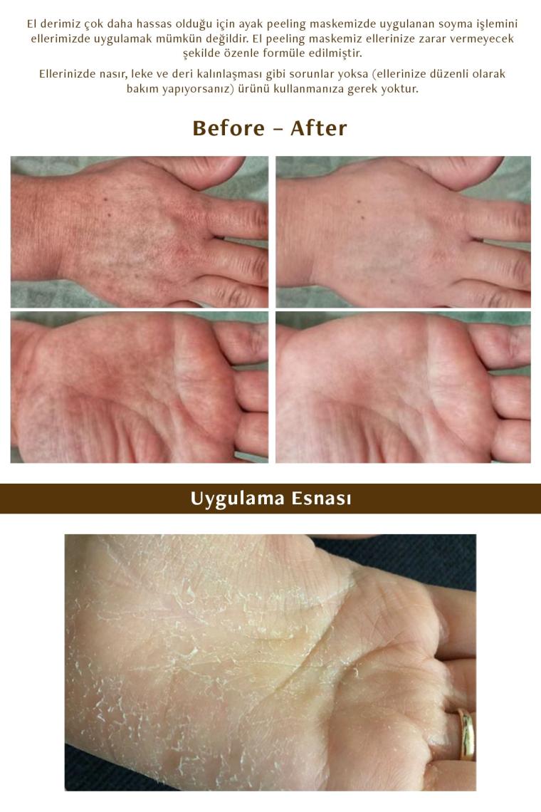 Hand Peeling - Soyulan El Peeling Maskesi