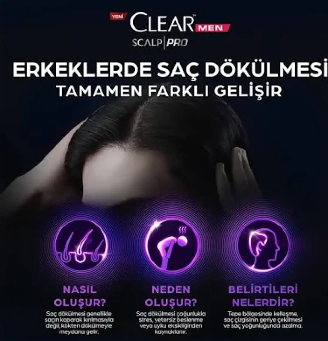 Men Scalp Pro Güçlendirici Serum Saç Dökülmesine Karşı 70 ml