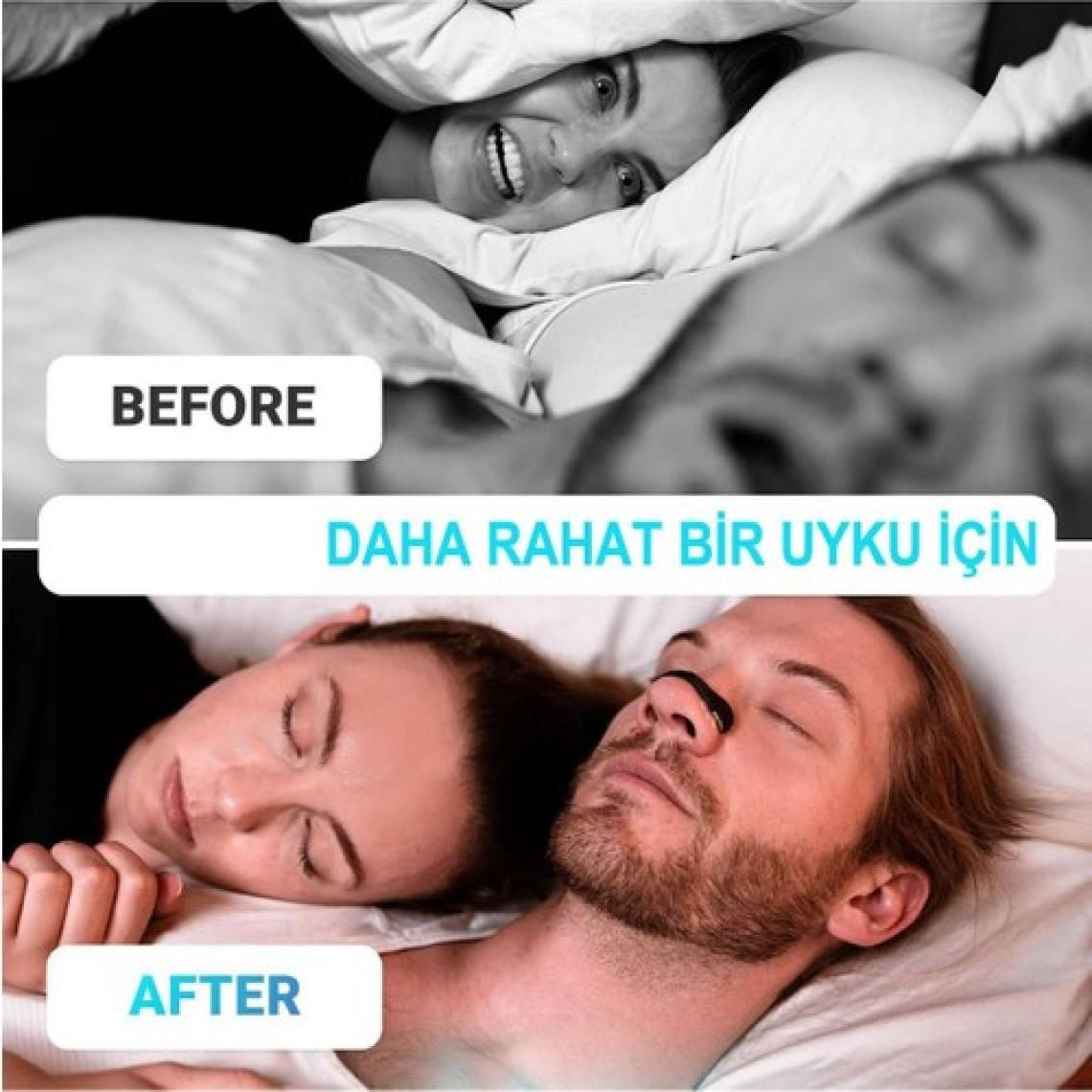 Gildron Horlamayı Azaltıcı Mıknatıslı Burun Bandı - Dilatörü 4'lü Set